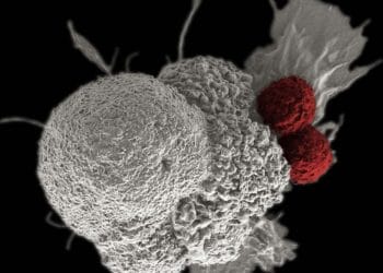 Jika Anda Sering Mengalami 10 Gejala Ini, Waspada Terhadap Risiko Kanker